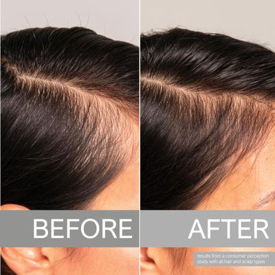 Scalpify Advanced Hair Serum Nourishing Scalp Serum Non Oily Treatment for Enhanced Hair Support and Thickness Perfect for Men Women 30mL