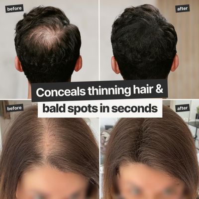 IMPERIO Hair Building Fibers for Thinning Hair - 26g Premium Hair Fibers for Women Men in Hairdresser Quality - Hair thickening in less than 20 seconds (Medium Blonde)