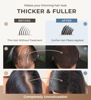 CONFIERR Keratin Hair Fibers for Men Women - Fill In Fine or Thinning Hair, Instantly Thicker, Fuller Looking Hair (Medium Brown 30g)