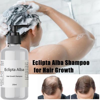Eclipta Alba Shampoo for Hair Growth, Organic Bhringraj Oil Infused, Strengthens Nourishes Hair Roots, Hydrates, Prevents Hair Loss, Safe for All Hair Types - 250ml