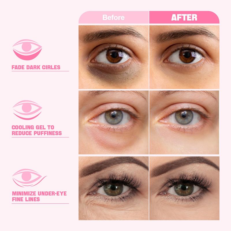 ZealSea Under Eye Patches for Puffy Eyes and Dark Circles (Collagen, 20pairs), Anti-wrinkle Patches, Eye Bags Remover for Women, Eye Masks-Pads-Gels for Spa Party Christmas Gifts, Vegan Cruelty-Free
