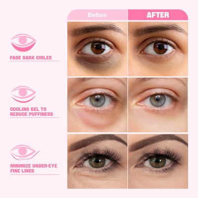 ZealSea Under Eye Patches for Puffy Eyes and Dark Circles (Collagen, 20pairs), Anti-wrinkle Patches, Eye Bags Remover for Women, Eye Masks-Pads-Gels for Spa Party Christmas Gifts, Vegan Cruelty-Free