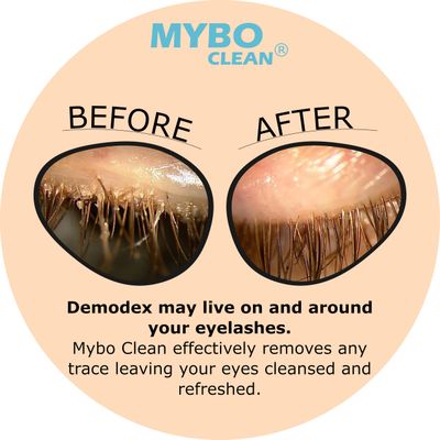 Mybo Clean Eyelid Cleansing Brush for Sensitive Skin (1 Pc) Hydrating Lids and Lash Cleansing Gel (1Pc) Travel Bag Ideal for Gentle Cleansing of the Eyelids On the Go