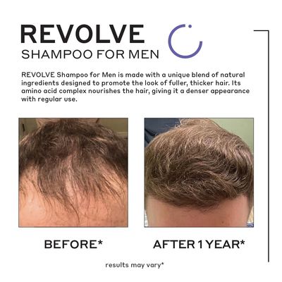 ZENAGEN Revolve Men's Thickening Shampoo Supports Appearance of Fuller, Healthier-Looking Hair, Developed for Fine Visibly Thinning Hair, Plant-Based, Color-Safe, Vegan, All Hair Types, 6.75 oz