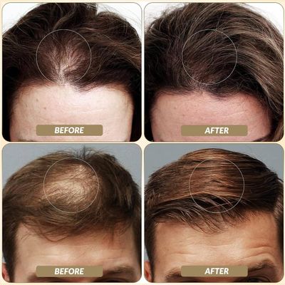 SOVONCARE Hair Fibers for Thinning Hair Gray, Hair Building Fibers for Bald Spots Undetectable Natural, Conceals Hair Loss Fill In Fine, Hair Powder Hair Thicker Instantly for Women Men 28g