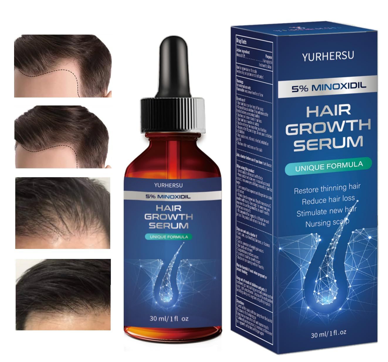 Hair Growth Serum, 5 Minoxidil, With Biotin Glycerin, for Men&#39;s Beard Women&#39;s Hair Regrowth, Anti Hair Loss Treatment, Make Hair Stronger Thicker Longer, 1 fl oz (30 ml)