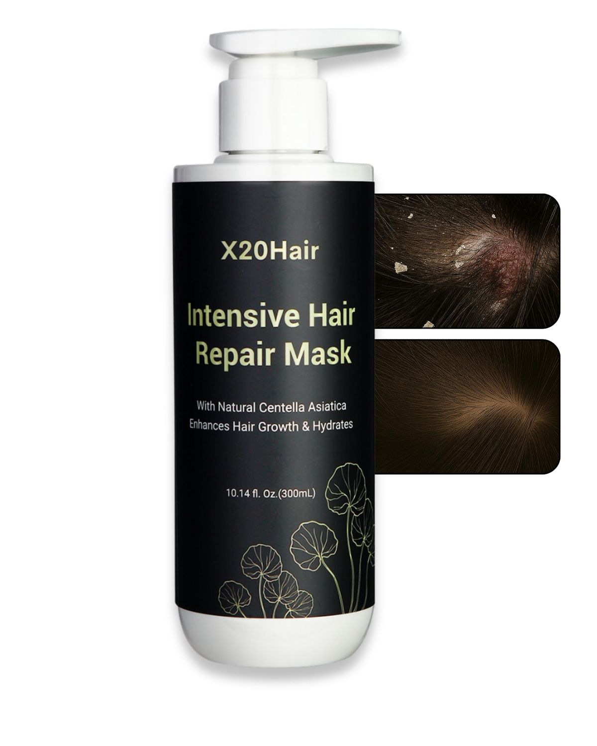 Folliculitis Hair Repair Mask - Effective Scalp Treatment for Seborrheic Dermatitis,Psoriasis, Dry Itchy Scalp, Dandruff Treatment Nourishes Oily Hair - Ideal for Women