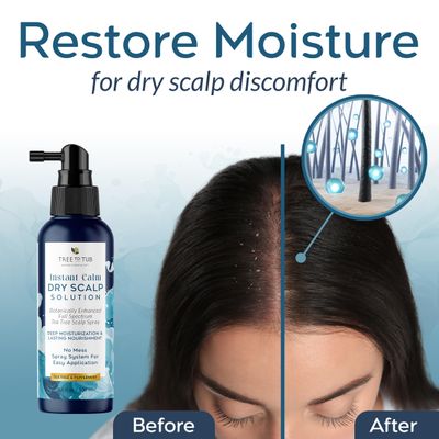 Tree To Tub Dry Scalp Spray - Intensive Scalp Moisturizer for Men Women - Tea Tree Leave in Scalp Moisturizer for Dry Scalp, Full Spectrum Scalp Spray for Flaky Buildup Excess Oil, Scalp Care