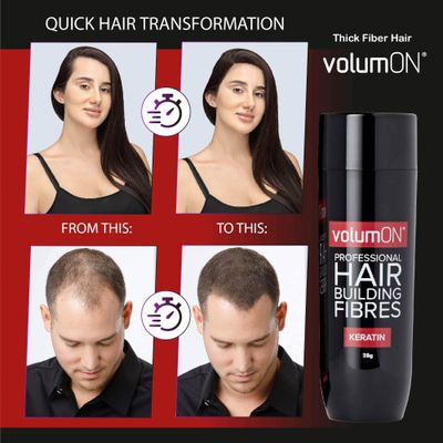 Volumon Professional Hair Building Fibres- Hair Loss Concealer- KERATIN- DARK BROWN 28g- Get Upto 30 Uses