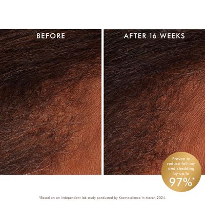 Moroccanoil Revitalizing Scalp Tonic Treatment for Thinning Hair