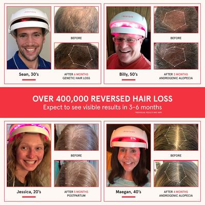 iRestore Essential Laser Hair Growth System Rechargeable Battery Pack - FDA Cleared Hair Regrowth for Men Women with Thinning Hair