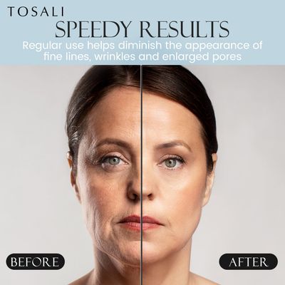 TOSALI Anti Aging Daily Peeling 6.8 oz - Exfoliator Peel Off Face Mask with Lactic Acid, Hyaluronic Acid Vitamin E - Hydrating Face Exfoliator, Skin Care For Women, All Skin Types