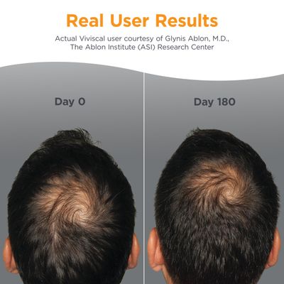 Viviscal Men's Hair Growth Supplements for Thicker, Fuller Hair Clinically Proven with Proprietary Collagen Complex, 60 Tablets - 1 Month Supply