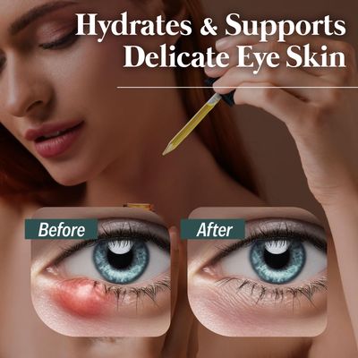 The Goodbye Company Eye Care Serum - 100 Natural Formula for Gentle Eye Support - Plant-Based Oils with Omega 3 9 - Soothing and Hydrating
