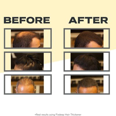 FIXDEEP Hair Thickener New Waterproof Formula - Natural Fuller Looking Fibers in 30 sec - 14g - For Thinning Hair, Bald Spots Graying Roots (Light Brown)