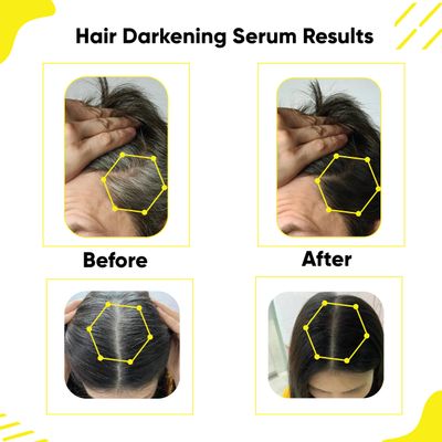 JUQOTU Masofta Hair Darkening Serum with Arcolys, Melano Gray, Biotin Bhringraj for Promoting Darker, Shinier Hair and Beard, Suitable for Both Men Women, 1.01 fl.oz.30 ml