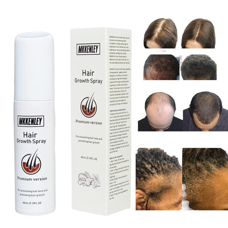 Magic Hair Growth Tonic with Ginseng - 60ML Hair Loss Treatment for Men Women, Fast Hair Regrowth Serum for Thicker, Fuller Hair