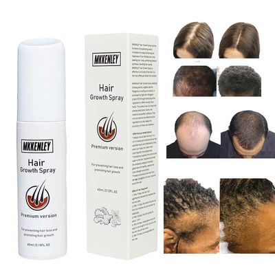 Magic Hair Growth Tonic with Ginseng - 60ML Hair Loss Treatment for Men Women, Fast Hair Regrowth Serum for Thicker, Fuller Hair
