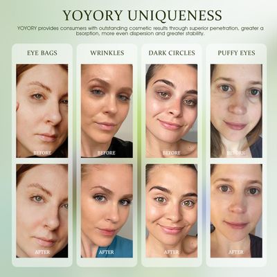 YOYORY Under Eye Patches - Eye Gel Masks for Wrinkles, Dark Circles, Puffy Eyes, Fine Lines, Eye Bags Treatment with Hyaluronic Acid Collagen, Moisturizing Hydrating 60Pcs,Green