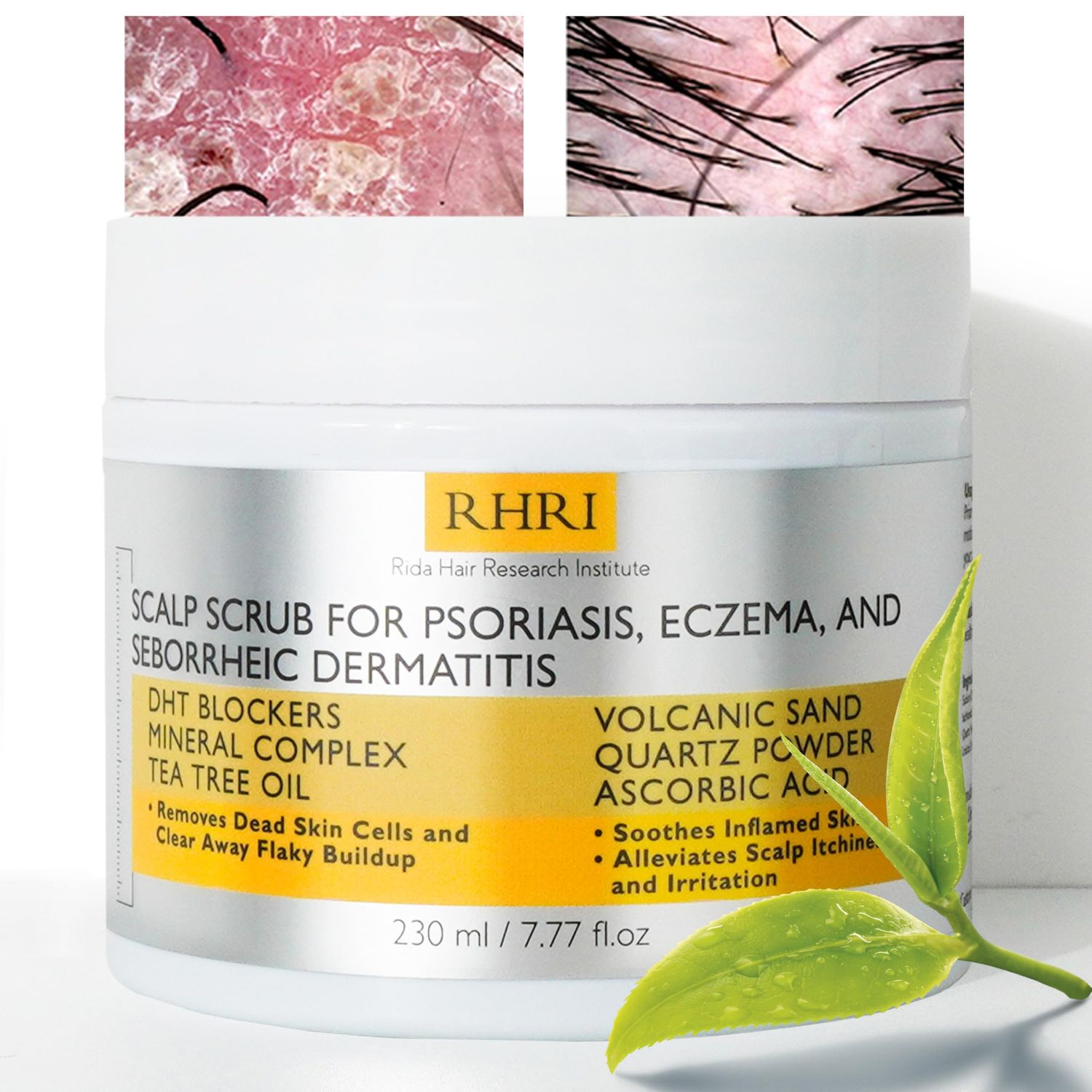 Anti Fungal Pre Shampoo Scalp Scrub for Psoriasis, Eczema Seborrheic Dermatitis DHT Blockers, Mineral Complex Tea Tree Oil Soothes Scalp and Promotes Hair Growth for Men Women