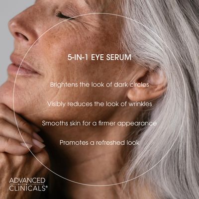 Advanced Clinicals 5-in-1 Eye Serum Multi-Benefit Visible Anti Aging Under Eye Serum Face Moisturizer Reduces Appearance Of Dark Circles, Puffy Eyes, Crows Feet, Wrinkles, Fine Lines, 2 Fl Oz