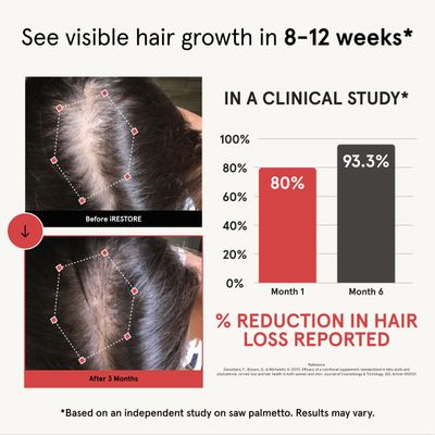 iRESTORE Hair Growth Supplement - Hair Loss Vitamins for Women and Men - Has Biotin Multivitamins DHT Blocker to Reduce Hair Thinning - Hair Regrowth Pills for Thicker Fuller Volume - 30 Days Supply