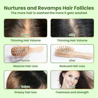 Rosemary Shampoo for Hair Growth: Thickening Regrowth Formula for Women Men - Rosemary Mint Strengthening Shampoo with Tea Tree Oil Biotin for Thinning Loss Hair Dry Damaged Care