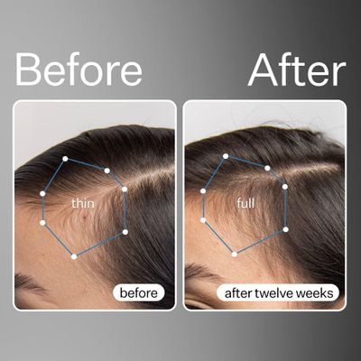 ACT ACRE Cold Processed Stem Cell Scalp Serum - Promotes Thicker and Fuller-Looking Hair - Soothes and Hydrates the Scalp - Sulphate and Paraben Free - Aloe Vera for Improved Scalp Health - 1 fl oz.