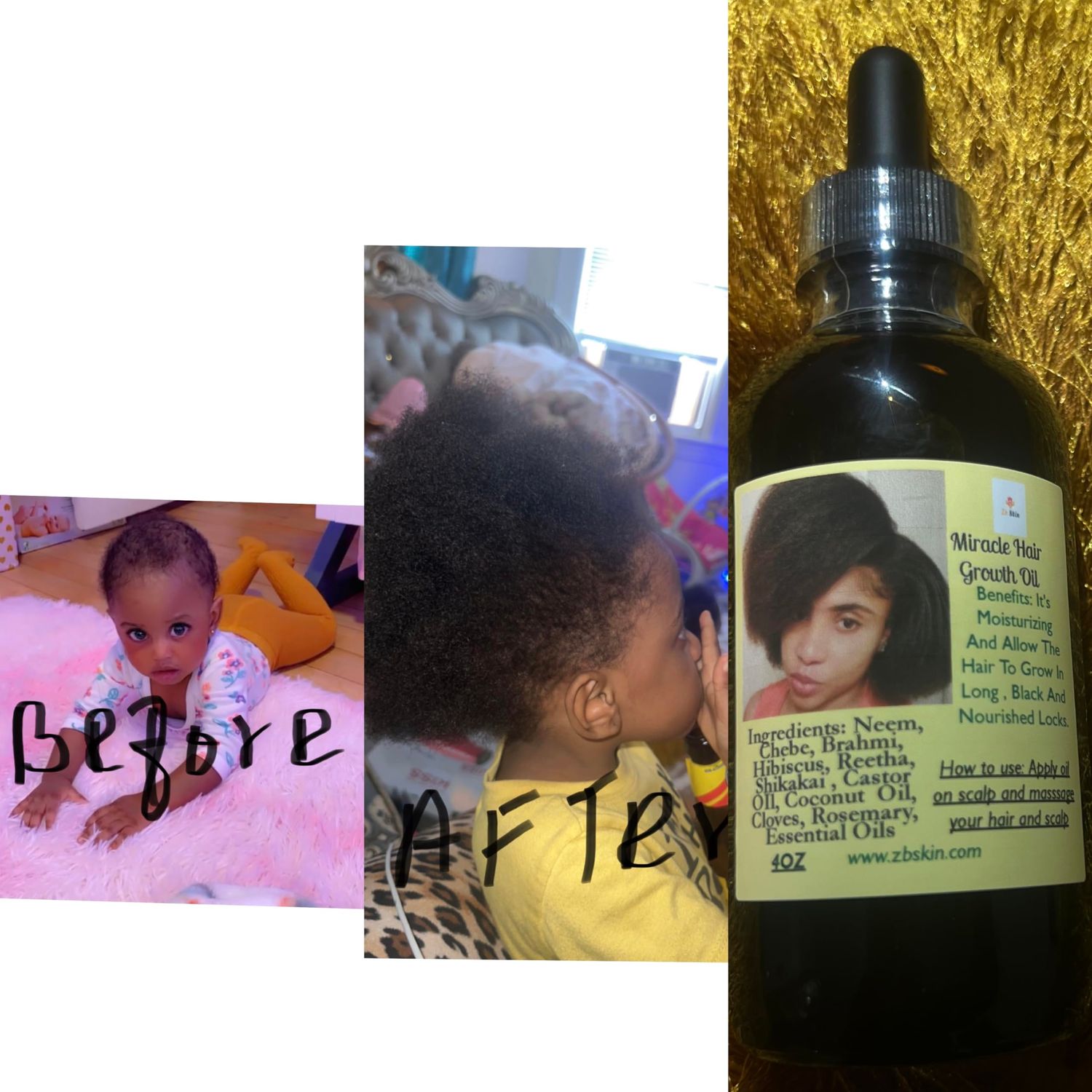 ZB SKIN Miracle Hair Growth Oil for Thick Hair, Coconut Scent, Unisex-Adults