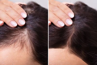 velona Hair Growth Formula - 4 oz Castor, Amla, Jojoba, Argan, Rosemary, Peppermint, Tea Tree Oils, Vitamin E Natural Mix with Organic Carrier and Essential Oils