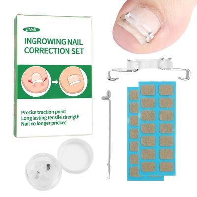 Zanchara Ingrown Toenail Corrector Kit for Men Women - Ingrown Nail Tool - Curved Nail Strips &amp; Toe Pads for EmbeddedCurled Nails