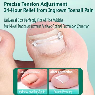 Zanchara Ingrown Toenail Corrector Kit for Men Women - Ingrown Nail Tool - Curved Nail Strips &amp; Toe Pads for EmbeddedCurled Nails