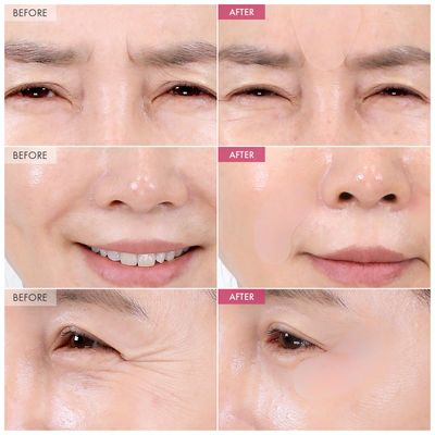 TOSOWOONG Anti-Wrinkle Patch with Hydrolyzed Collagen, Forehead & Eye & Smile Line Wrinkle Patches, Anti-Wrinkle Tape, K-Beauty Overnight Under Eye Patches, Korean Skincare, 5ea 10patches X 5