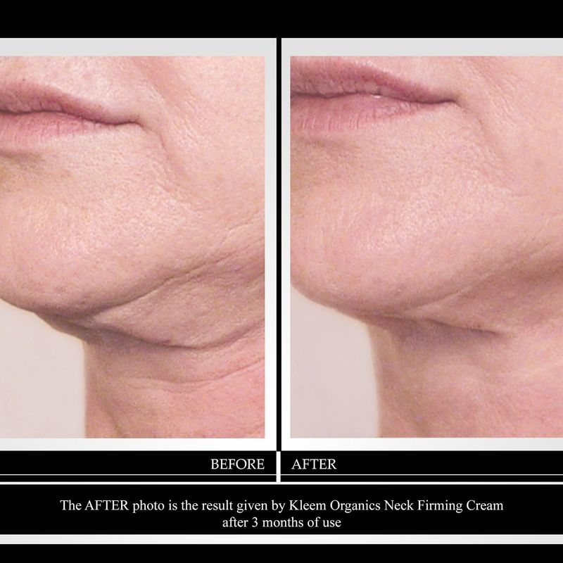 Neck Firming Cream with Peptides &amp; Retinol - Anti Aging Skin Tightening Cream to Reduce Wrinkles, Neck Lines, Age Spots &amp; Sagging Skin - Natural Firming Neck Cream for Smooth &amp; Youthful Skin - 1.7 oz