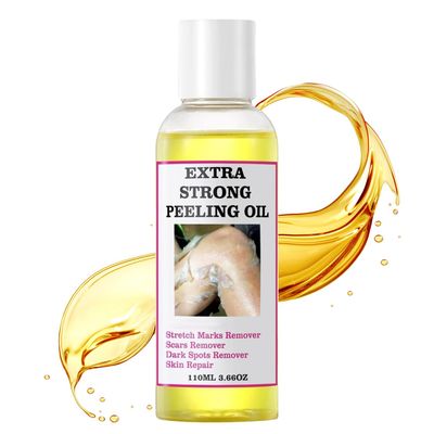 Chemical Peel for Face - Peeling Oil for Facial &amp; Body Exfolianting with 16 Salicylic Acid - Dead Skin Remover with Gentle Formula for All Skin Type - 120 mL