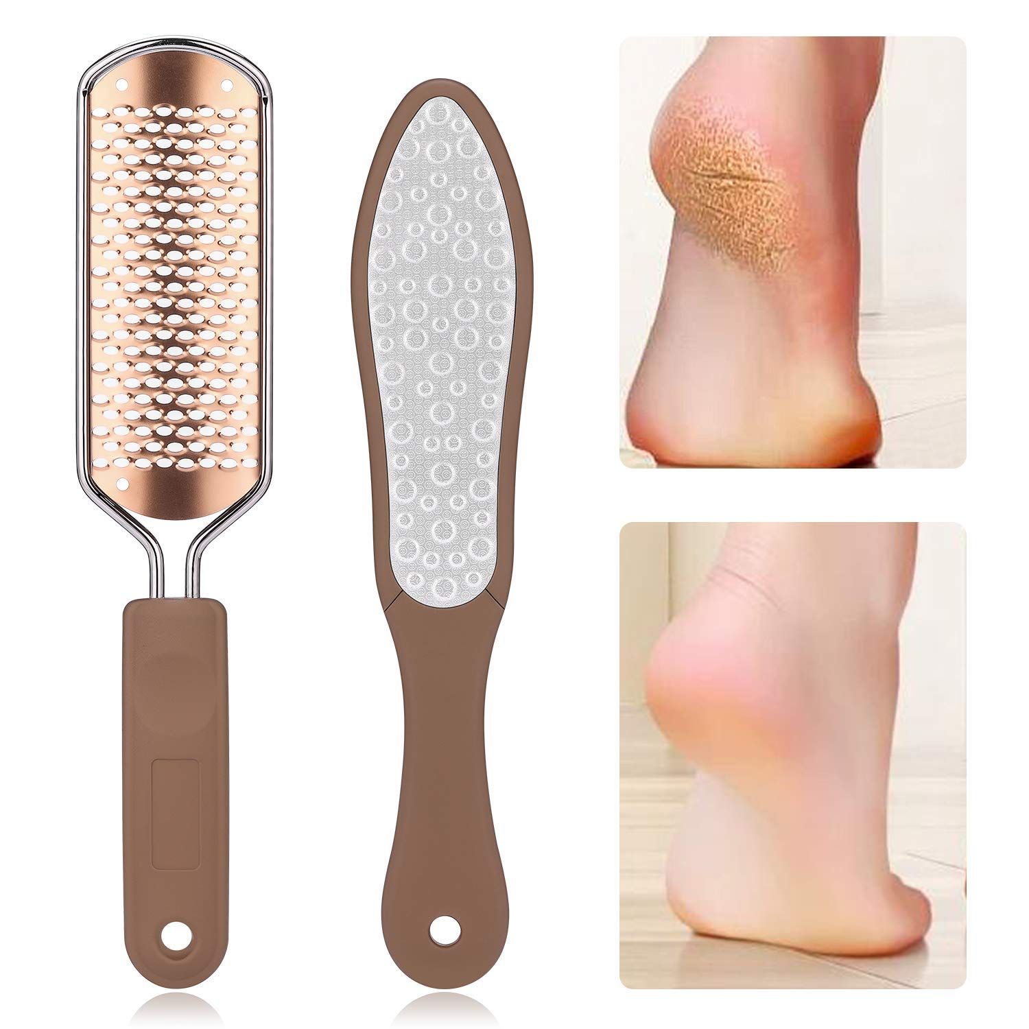 Oneleaf 2PCS Professional Pedicure Rasp Foot File Cracked Skin Corns Callus Remover for Extra Smooth and Beauty Foot Black Rose