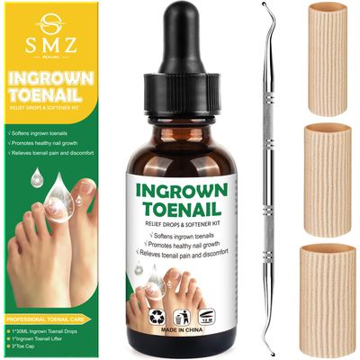 Ingrown Toenail Treatment: Ingrown Toenail Tool for Men Women - Ingrown Toenail Removal Kit - Ingrown Toenail Corrector Drops - Ingrown Toenail Remover - Effective Solution for Ingrown Toenails - 30ml