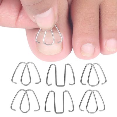 Toe Nail Correction Wire,Toe Nail Correction Tool, Wire Straightening Pedicure Treatment Foot Care Tool for Nail Recover Foot Care, Bunion Corrector for Men and Women