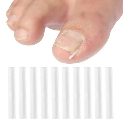 10 Pcs Ingrown Toenail Correction Strips Brace Kit, Ingrown Toenail Corrector Straightener Strips Recover Clips Toenails Thick Pedicure Tool Toenail Straightener Strip for Men Women Foot Care Tool Gr