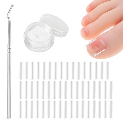 (501) Pcs Ingrown Toenail Treatment Corrector Set, Professional Pain-Free Ingrowns Toenails Removal Kit with Toenail Lifter, Toenail Strip for Men Women, Easy Fixed Ingrowns Toenails Tool