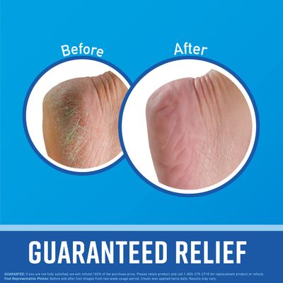 OKeeffes for Healthy Feet Foot Cream; Guaranteed Relief for Extremely Dry; Cracked Feet; Instantly Boosts Moisture Levels; 3.2 Ounce Jar; (Pack of 4)