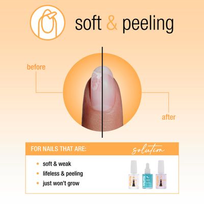 Nail Tek Recovery Kit - Nail Repair for Damaged Nails, Hydrate, Renew, &amp; Strengthen Nails Treatment, Made in USA, 0.5 fl oz each