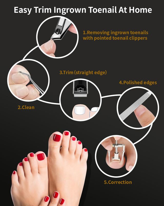 EBEWANLI Ingrown Toenail Tool, 6 PCS Stainless Steel Pedicure Tool, Straight Edge and Curved Slanted Nail Clippers Cutters for Ingrown Toenail Correction Removal Kit at Home for Seniors, Men, Women