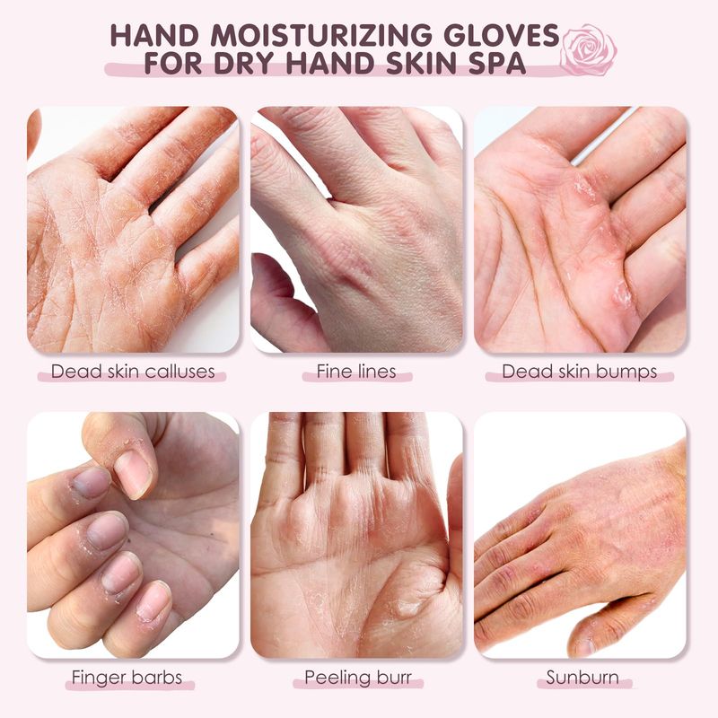 AUSLKA Hand Mask Moisturizing Glove 6 Pairs, Hand Care Moisturizing Gloves with Shea Butter, Hydrating Hand Masks, Hand Peeling Mask for Dry&amp; Dead Skin, Men Women (Rose)