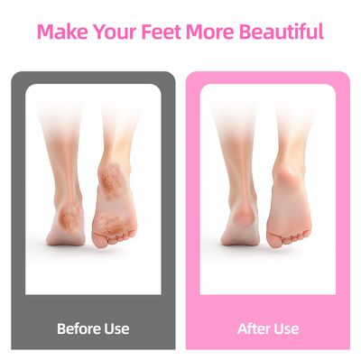 MARSDREAMS Electric Foot Callus Remover, Cordless Rechargeable Adjustable Speed Feet File with Nano Glass Grinding Disc, Wireless Professional Pedicure Tool for Heel Dead Skin and Calluses
