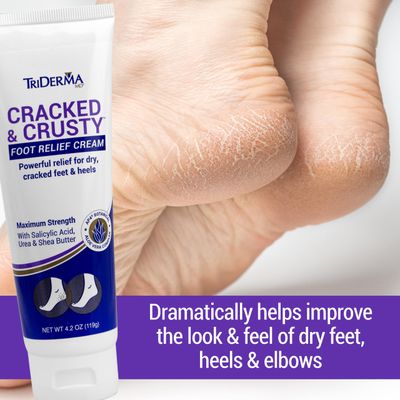 TriDerma Cracked & Crusty Healthy Foot Cream Moisturizes, Softens and Heals Dry Feet, Cracked Heels and Dry Elbows with Salicylic Acid, Urea, Shea Butter, AP4 Aloe and Vitamins, 4.2 Ounces