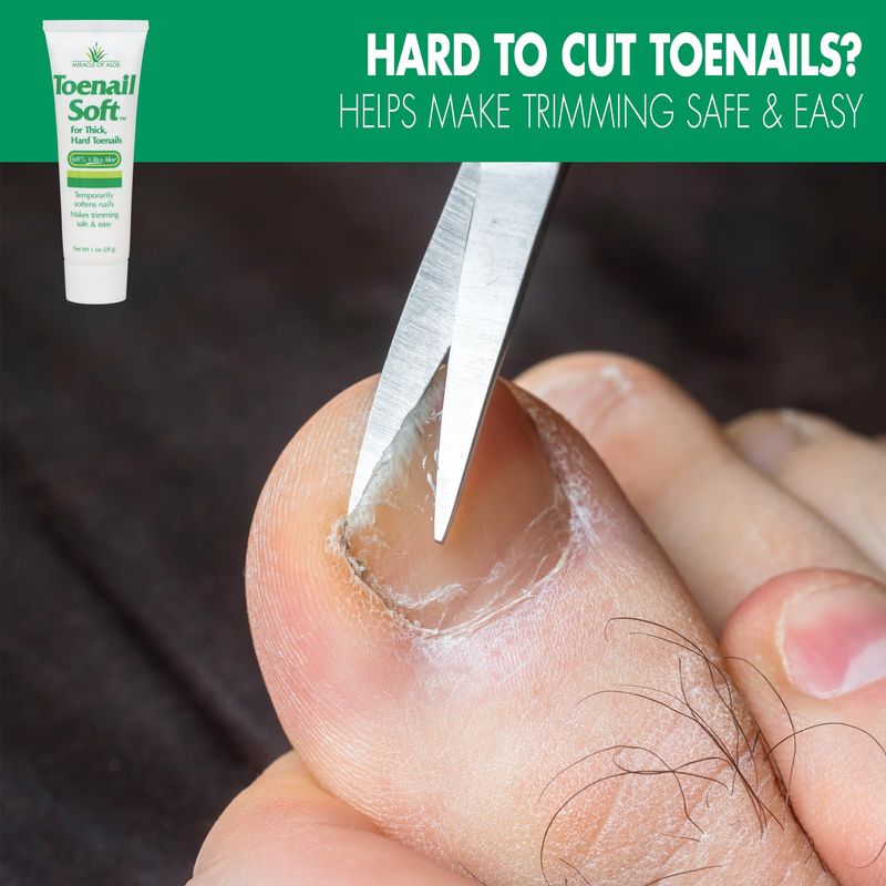 Toenail Softener for Thick Hard Toenails - Safe for Seniors &amp; All Ages - Fast-Acting Toenail Softening Cream - Ingrown Toenail Treatment - Non Greasy Nail Cream Formulated with Natural Aloe Vera, 1 oz