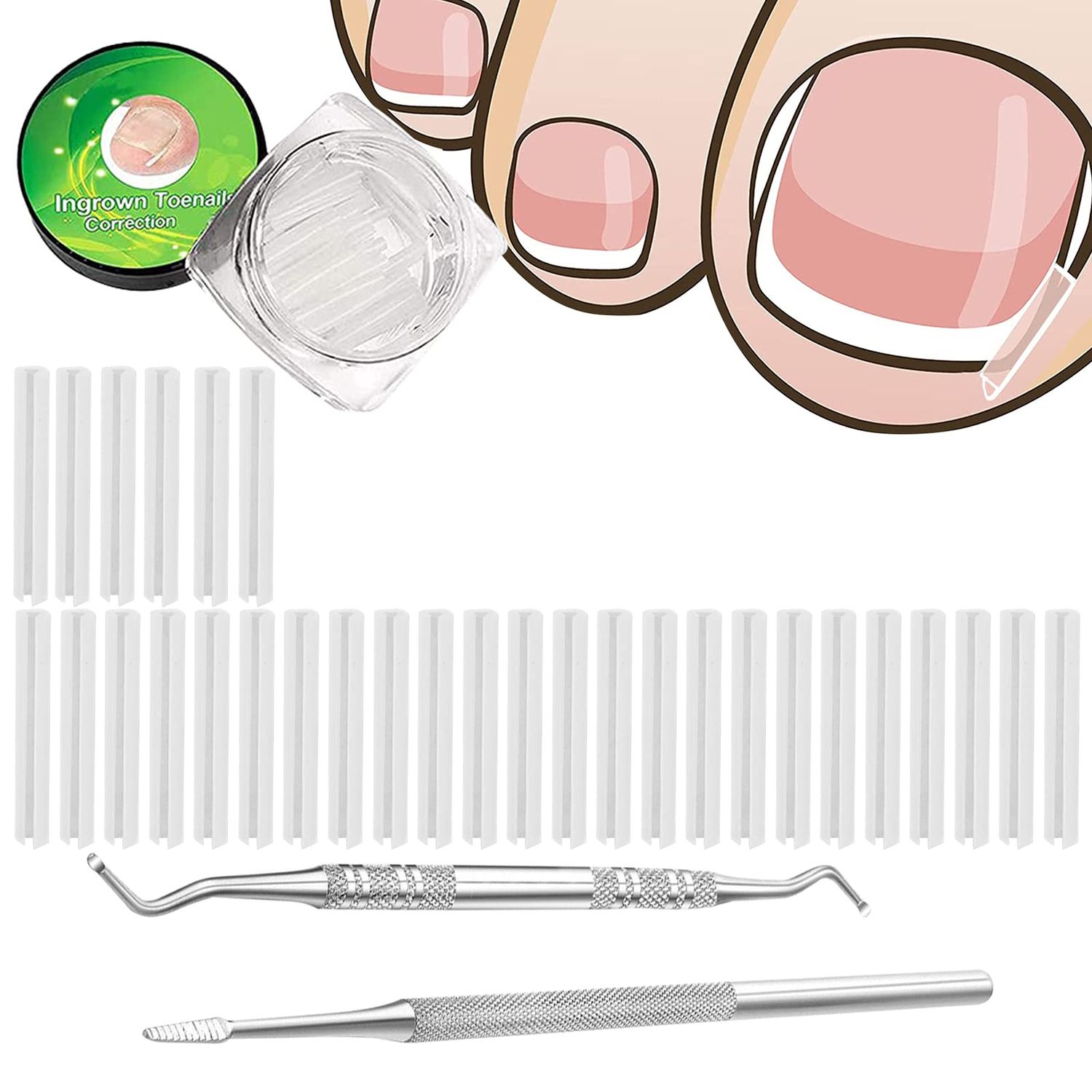 (302) Pack Ingrown Toenail Correction Treatment Kit, 30PCS Ingrown Toenails Corrector Strips Brace Ingrown Toenail Pedicure Tool Toenail Correction Patch with 2PCS Ingrown Toenails Lifter and File