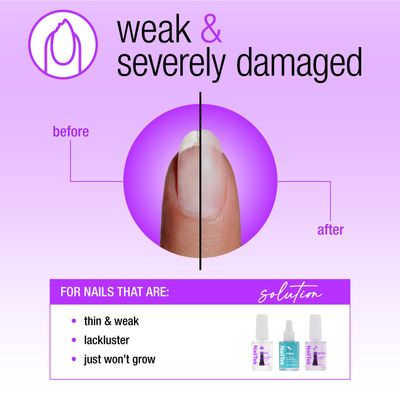 Nail Tek Rescue System - Nail Repair for Damaged Nails, Hydrate, Renew &amp; Strengthen Nails Treatment, Made in USA, 0.5 fl oz each