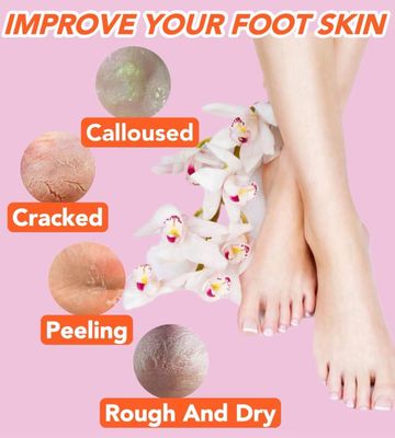 2 Pairs Silicone Socks for Dry Cracked Feet Women,Silicones Moisturizing Socks,Foot Spa Pedicure Silicone Socks for Repairing Dry Feet,Cracked Heels and Softening Rough Skin(Fits Up to Size 9)